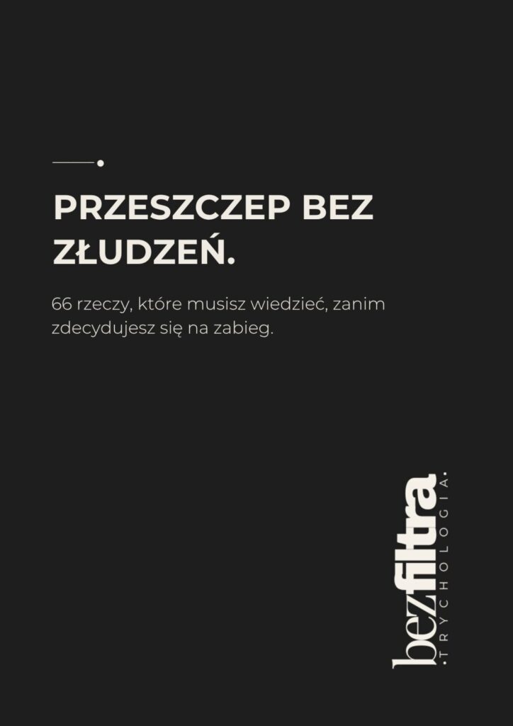 PROJEKT M. PRZESZCZEP BEZ ZŁUDZEŃ.